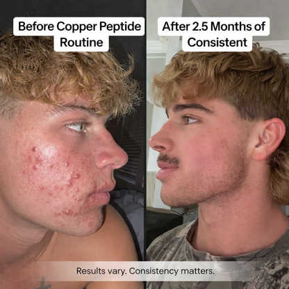 ReGEN™ Serum